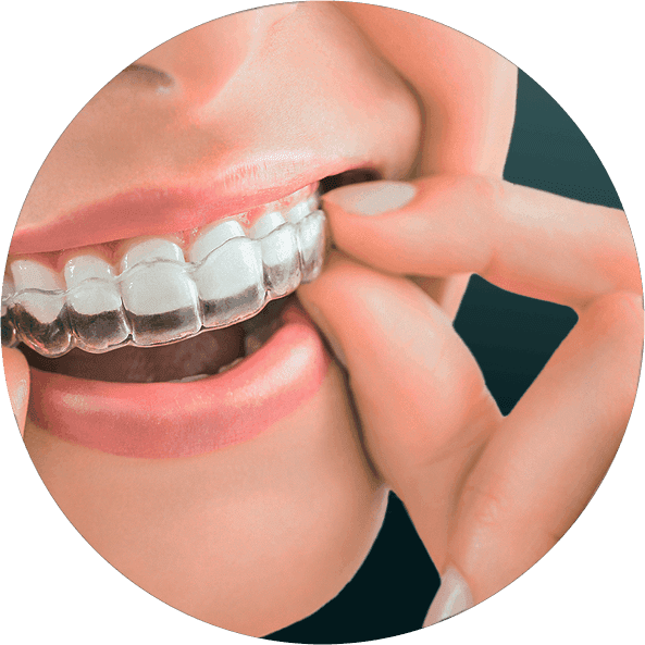 INVISALIGN
