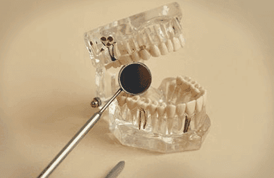 5: Formen und Polieren