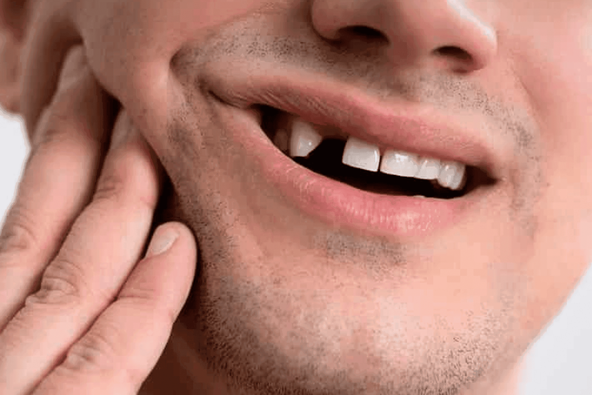 Dental Bridges3-min.png