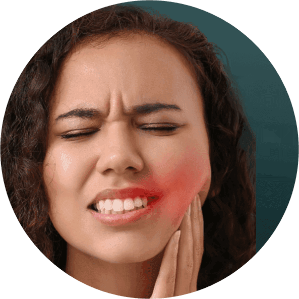 Wisdom Tooth3.png