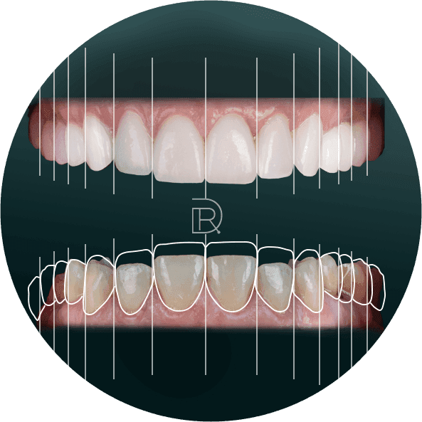 Smile Makeover.png