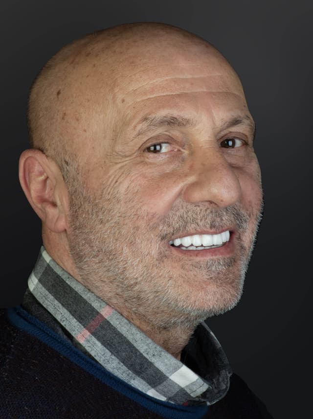 Zygomatic Implants