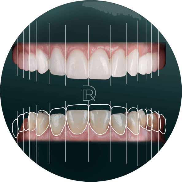 Smile Makeover.png