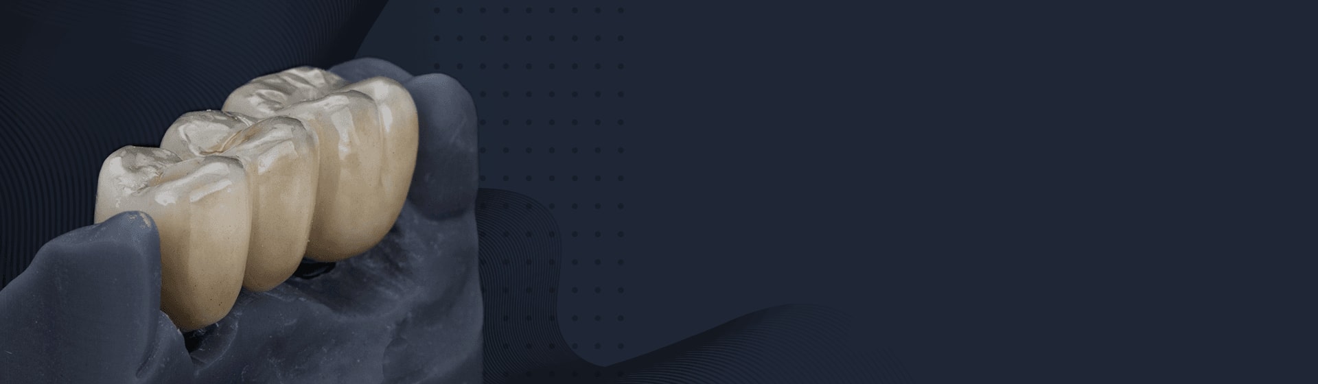 Zirconia Crown Prices Turkey, İstanbul