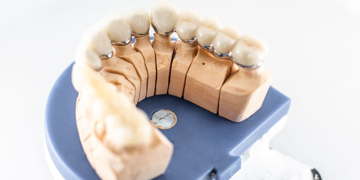 All-On-Six Diş İmplantı
