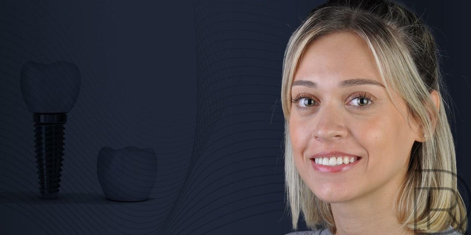 Banner-Implant 3-1.jpg