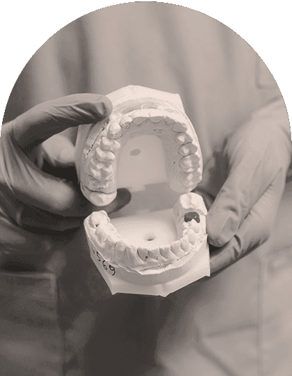 Arch Imaj-All on Four.png