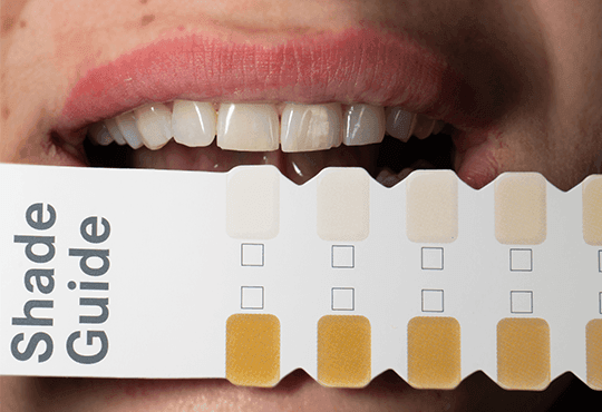 Teeth whitening 1.png