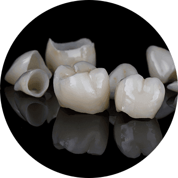 Composite Bonding-1.png