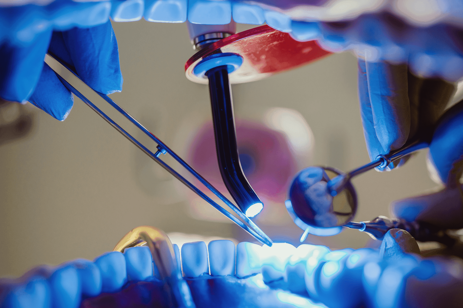 Dental Filling2-min.png