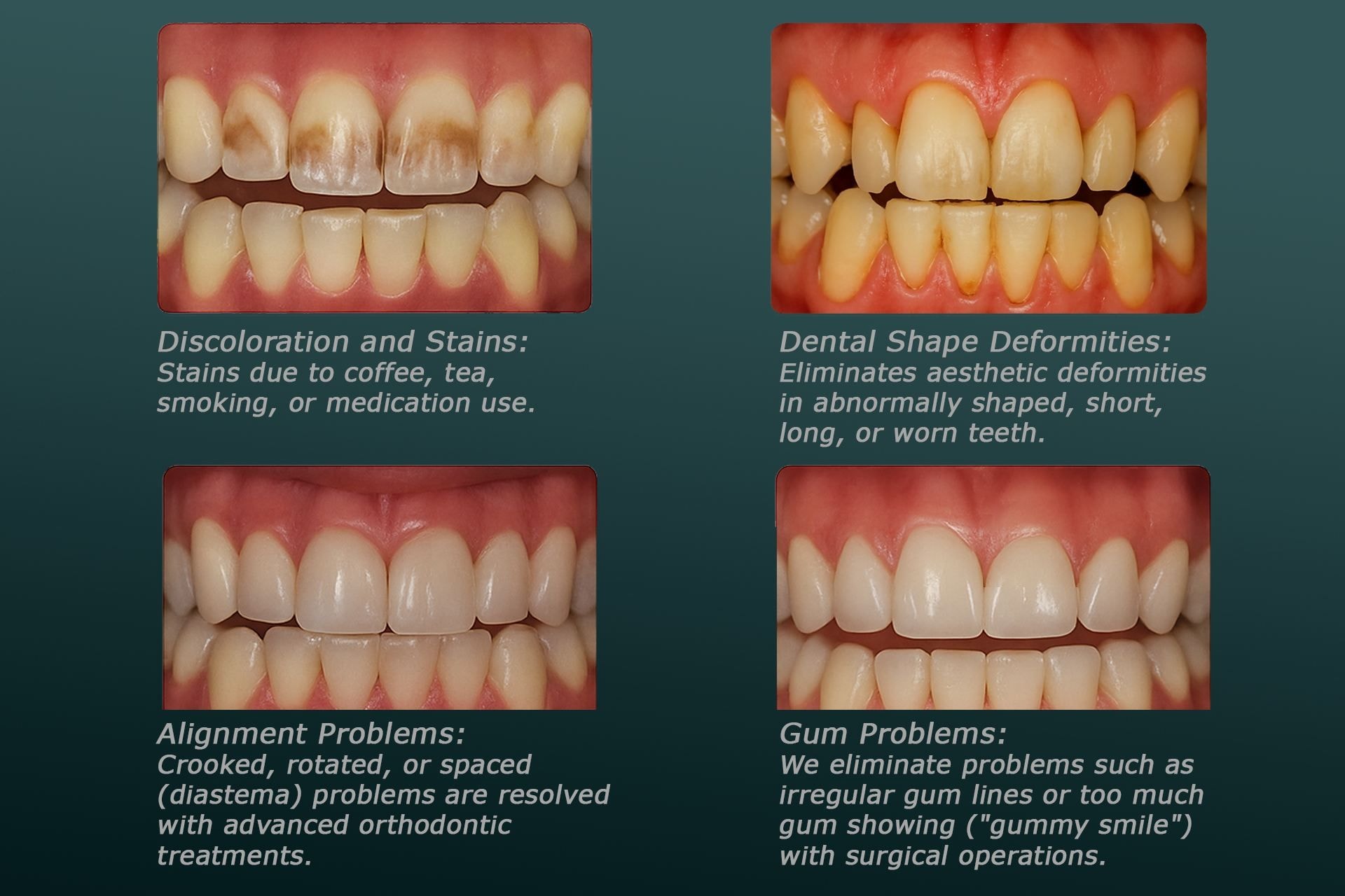 Smile Makeover3-compressed.jpg
