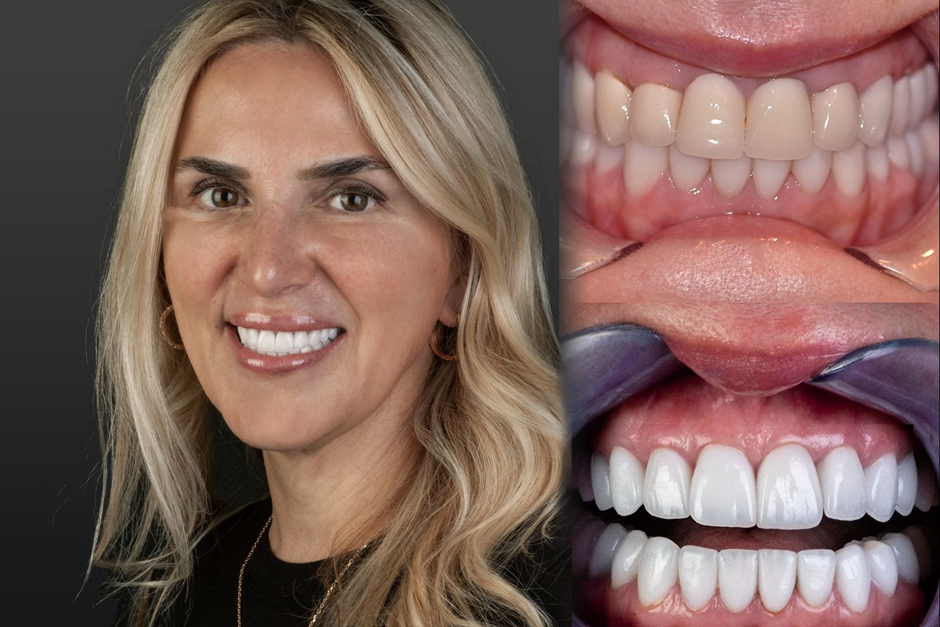 Smile Makeover2-compressed.jpg