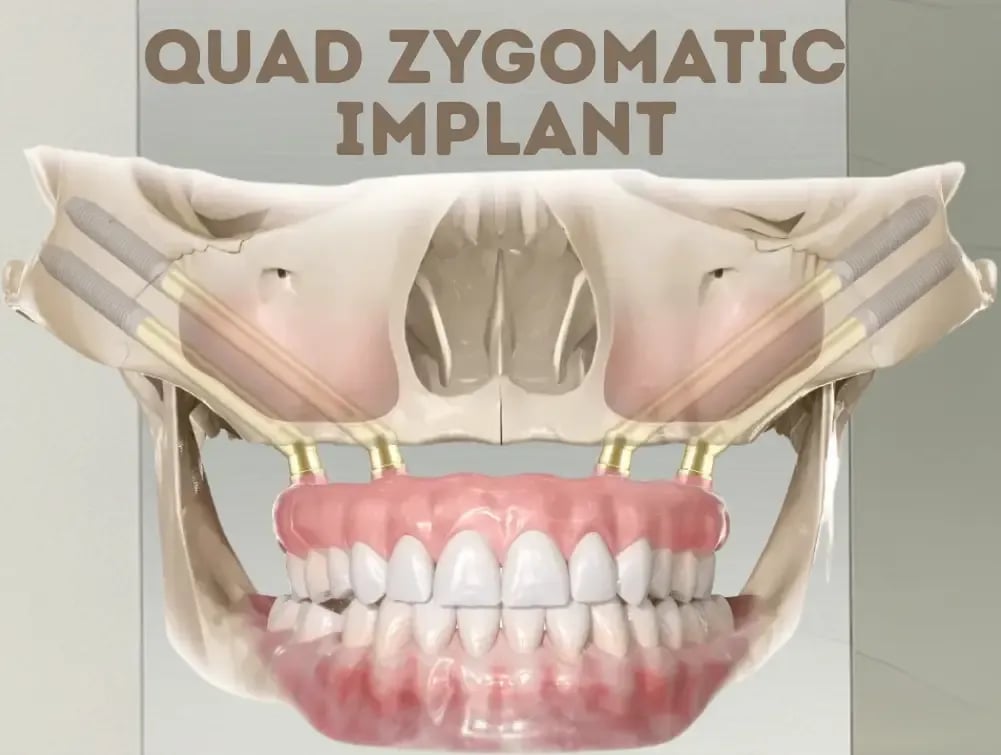 Paragraf metniniz (1).webp